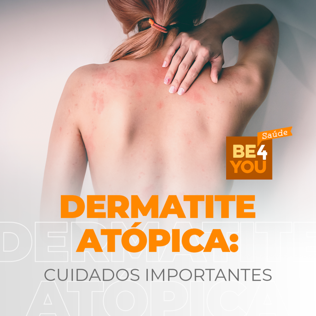 Dermatite Atópica Libelle Marketing Digital