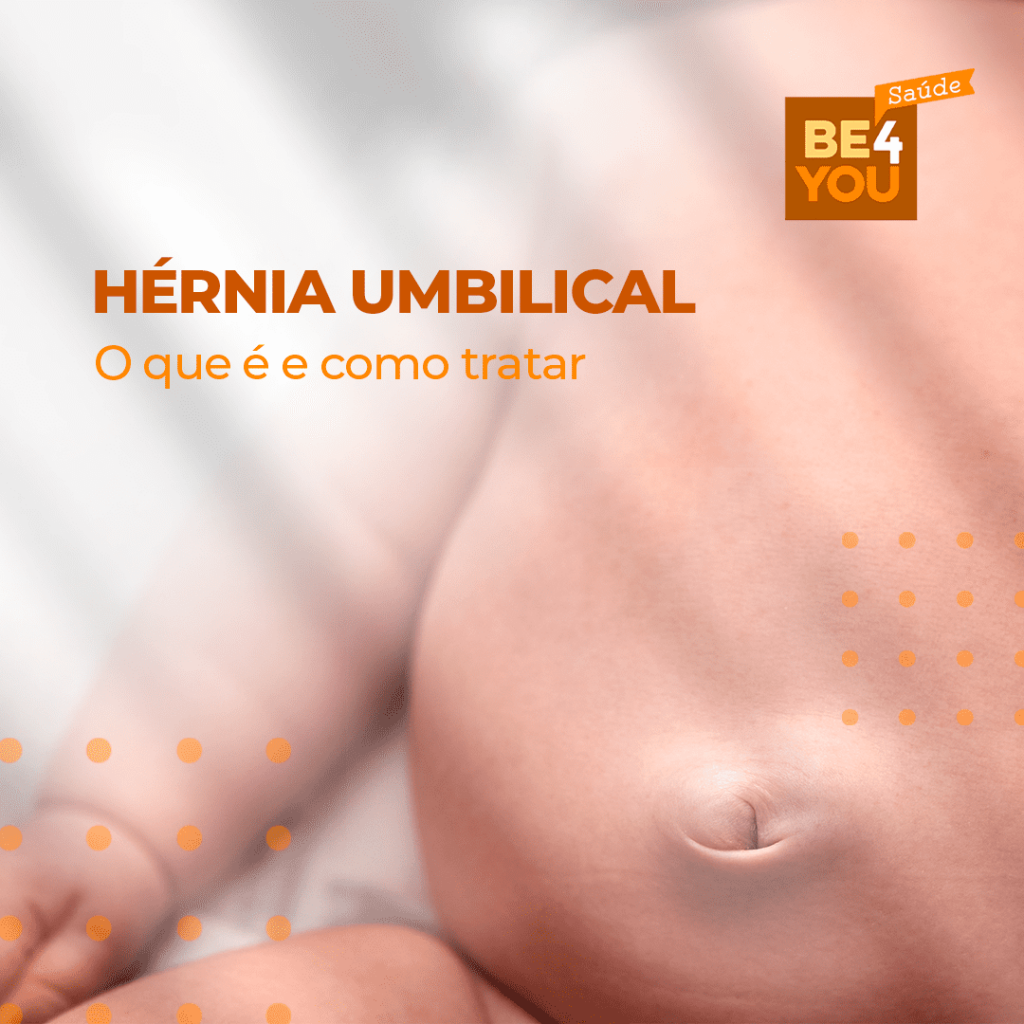 Hernia Umbilical: síntomas y tratamiento (con fotos) - Tua Saúde